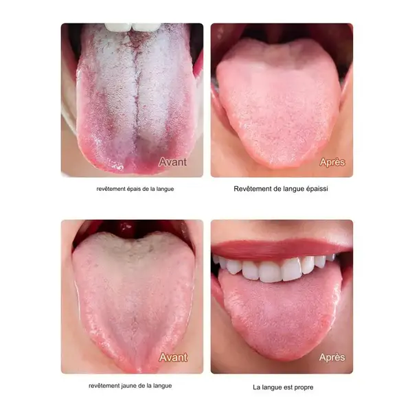 Gel buccal Nettoyant – Fraîcheur et Hygiène Optimale